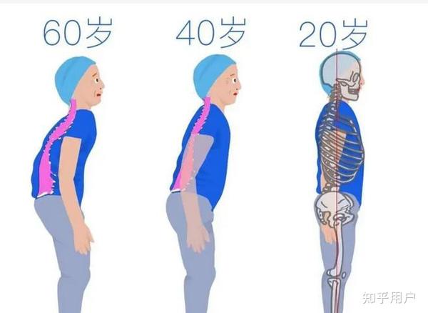 49图论坛：深度解读弯腰驼背与生肖玄机，一窥运势密码